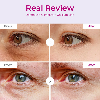 Cemenrete Calcium Multi Balm, Anti-aging, Sagging, Wrinkles