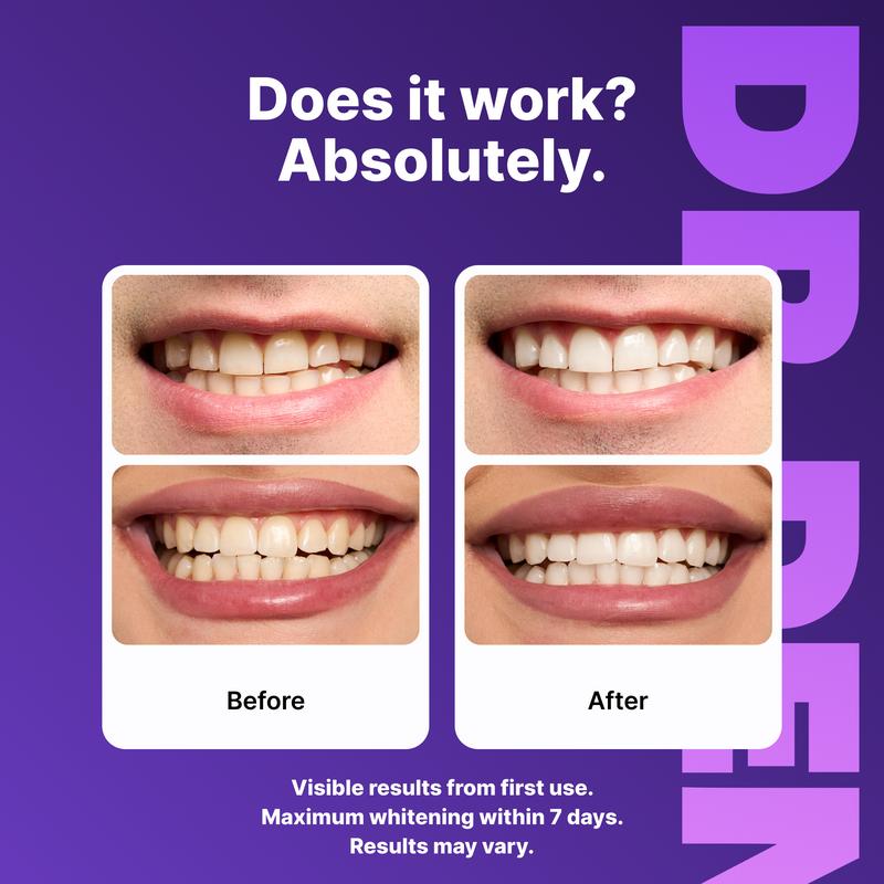 DRDENT Purple Teeth Whitening Strips - 21 Whitening Sessions - Safe for Enamel - Non Sensitive Teeth Whitening - Peroxide-Free