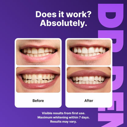DRDENT Purple Teeth Whitening Strips - 21 Whitening Sessions - Safe for Enamel - Non Sensitive Teeth Whitening - Peroxide-Free
