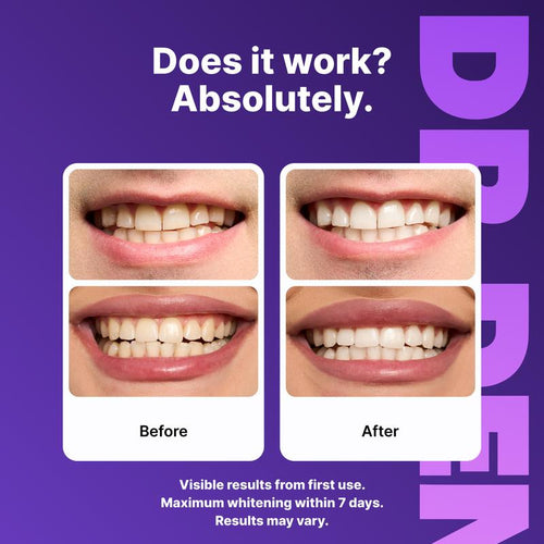 DRDENT Purple Teeth Whitening Strips - 21 Whitening Sessions - Safe for Enamel - Non Sensitive Teeth Whitening - Peroxide-Free